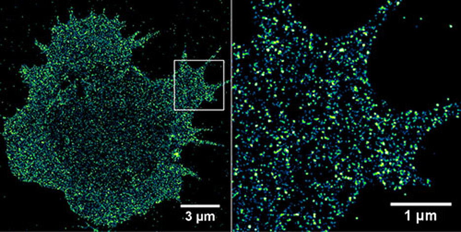 Immunrezeptoren auf einer Krebszelle. Mit Hilfe der hochauflösenden Fluoreszenzmikroskopie ist es möglich, Rezeptoren in der Zellmembran mit Einzelmolekül-Sensitivität zu visualisieren und zu quantifizieren. (Bild: Sebastian Letschert)