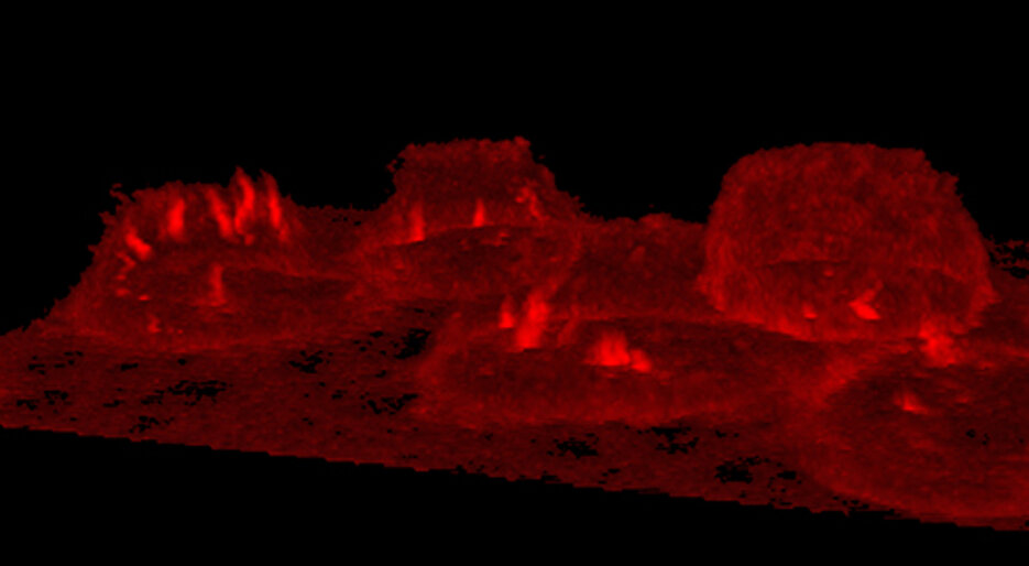 Sphingolipid-Moleküle unter dem Mikroskop.