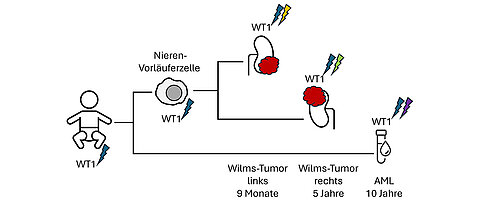 Bei einem Kind mit einer genetischen Veranlagung zum Wilms-Tumor trugen alle Körperzellen bereits eine mutierte Kopie des WT1-Gens. In der linken Niere bildete sich im Alter von 9 Monaten ein Wilms-Tumor, auf der rechten Seite entstand Jahre später ein weiterer Tumor. Mit 10 Jahren erkrankte das Kind schließlich an einer ebenfalls durch die WT1-Mutation ausgelösten akuten myeloischen Leukämie. 