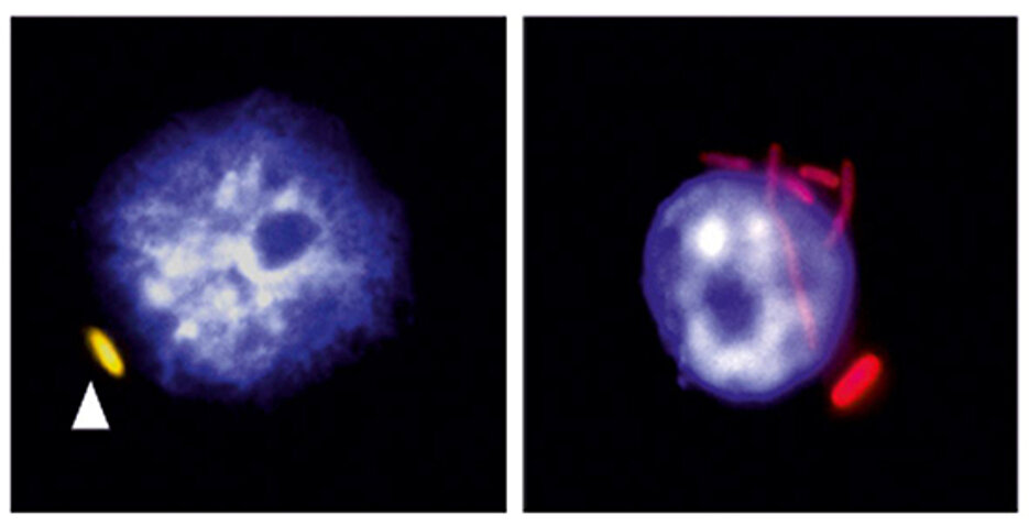 Links ein Makrophage (Zellkern in blau), in dem eine Salmonelle (gelb) ruht. Rechts ein Makrophage, in dem sich die Bakterien (rot) vermehrt haben. (Bild: Antoine-Emmanuel Saliba)